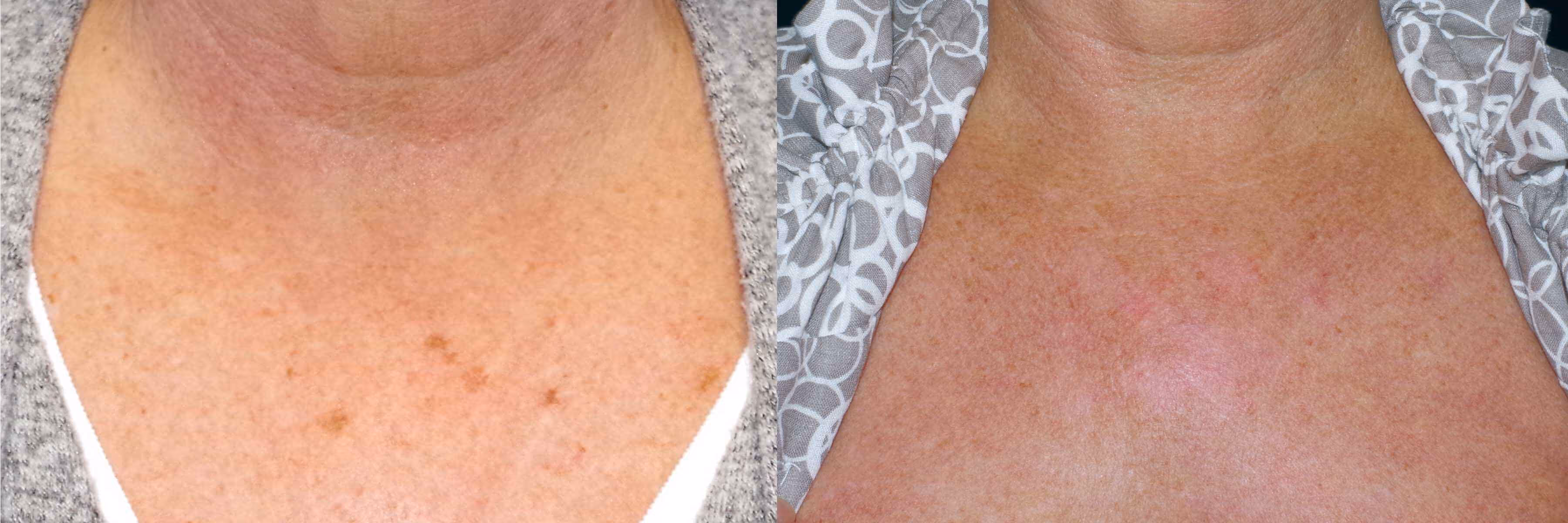 Before And After Patient Image