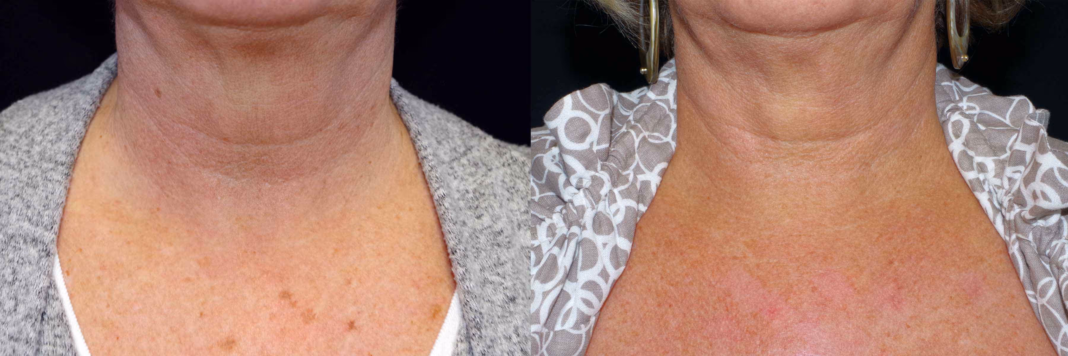 Before And After Patient Image