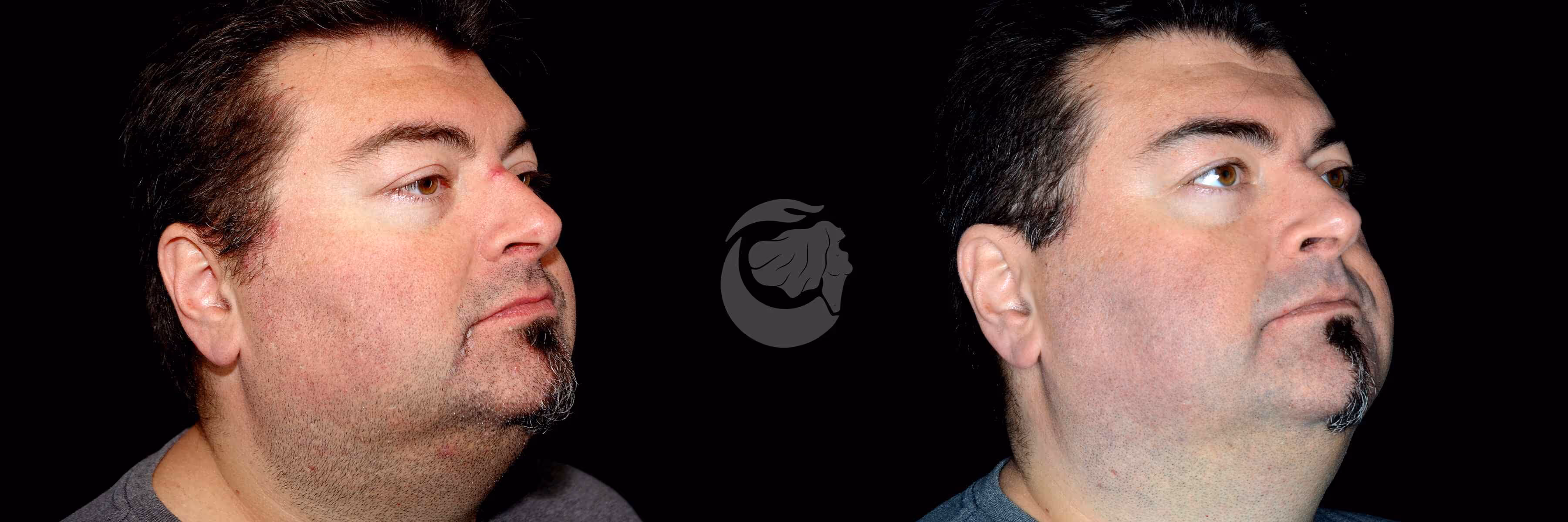 Before And After Patient Image
