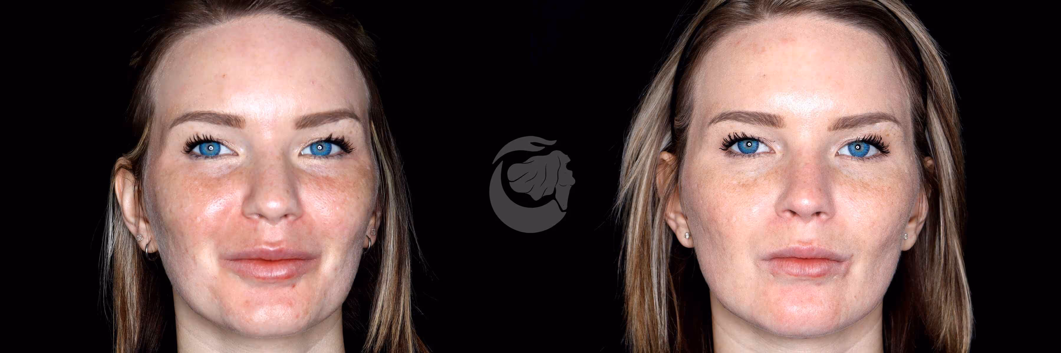 Before And After Patient Image