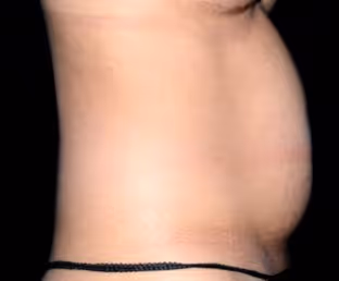 Plastic Surgery