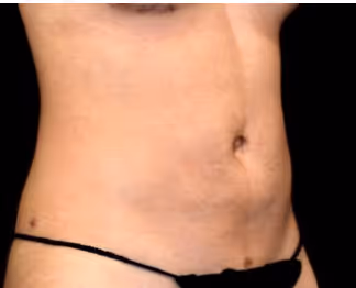Plastic Surgery