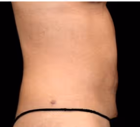 Plastic Surgery