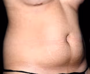 Plastic Surgery