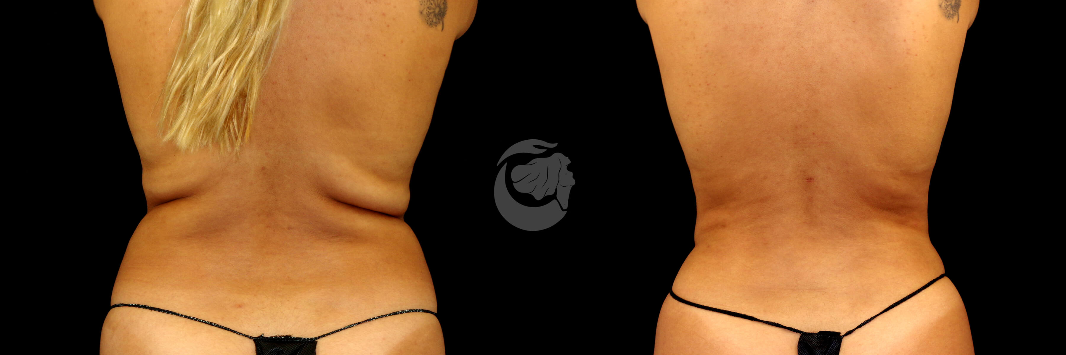 Before And After Patient Image
