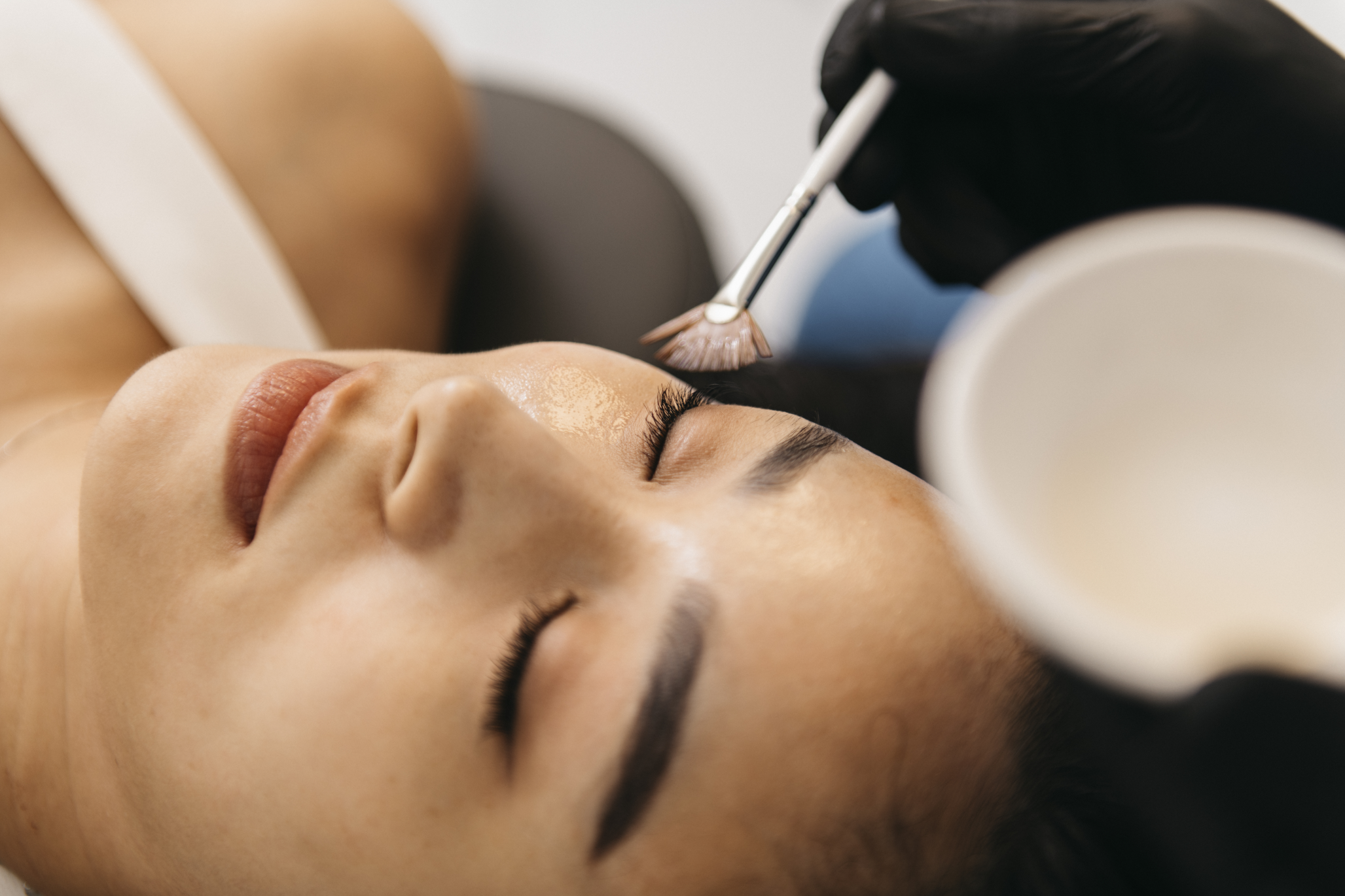 Chemical Peels in Edmonton | Reversal Laser Studio