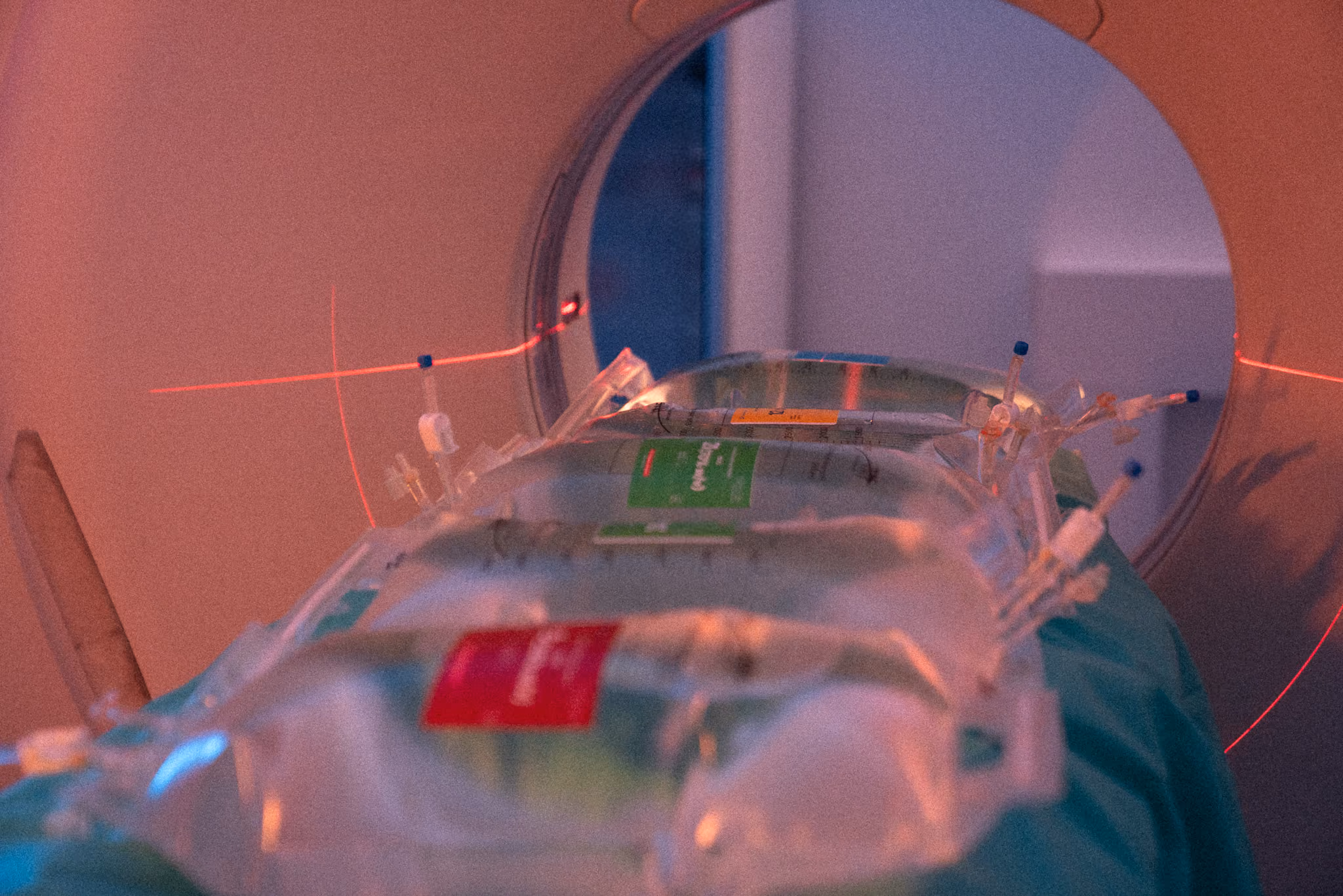 CT scanning