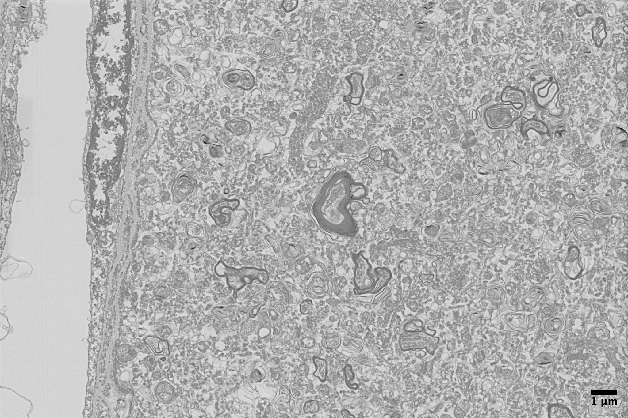 Electron microscopy of preserved tissue