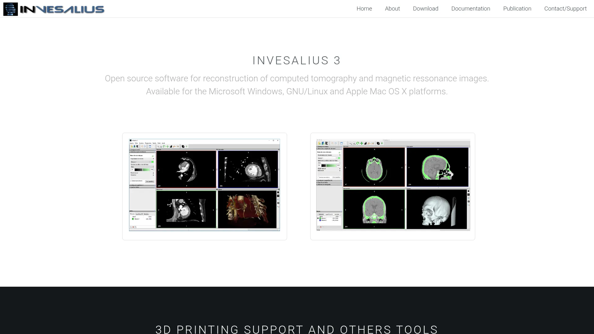 InVesalius 3D reconstruction software homepage