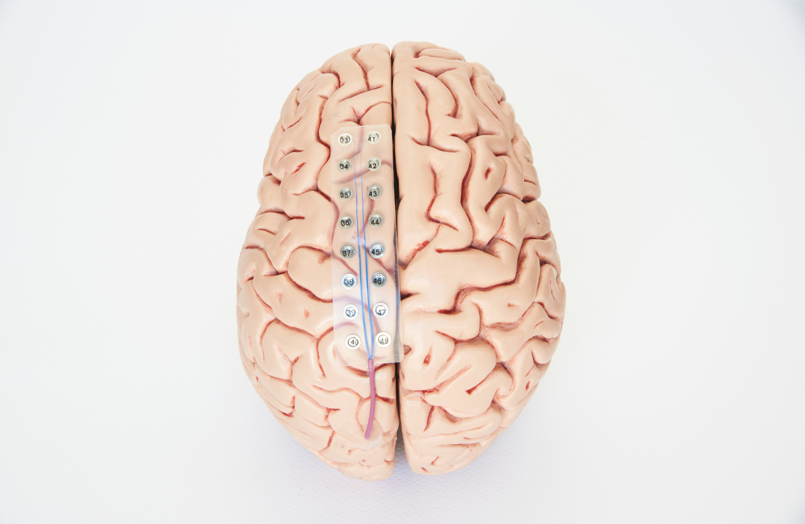 electrodes on brain model