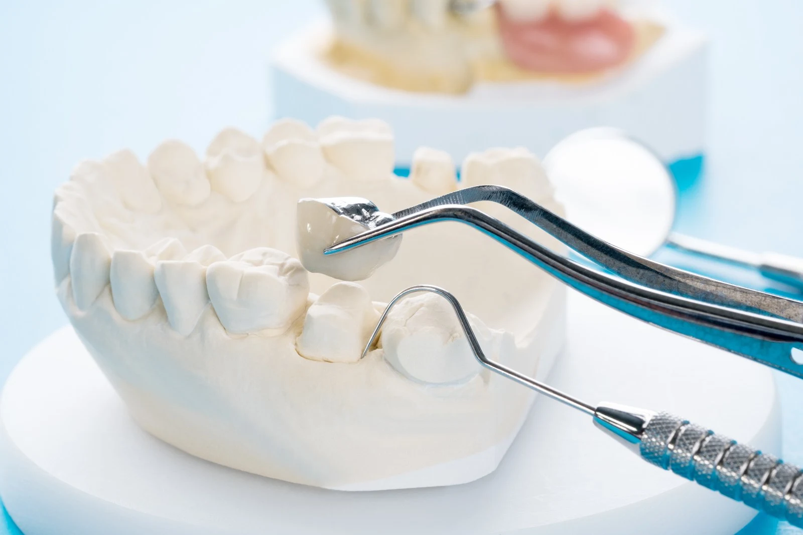 Crowns and Bridges