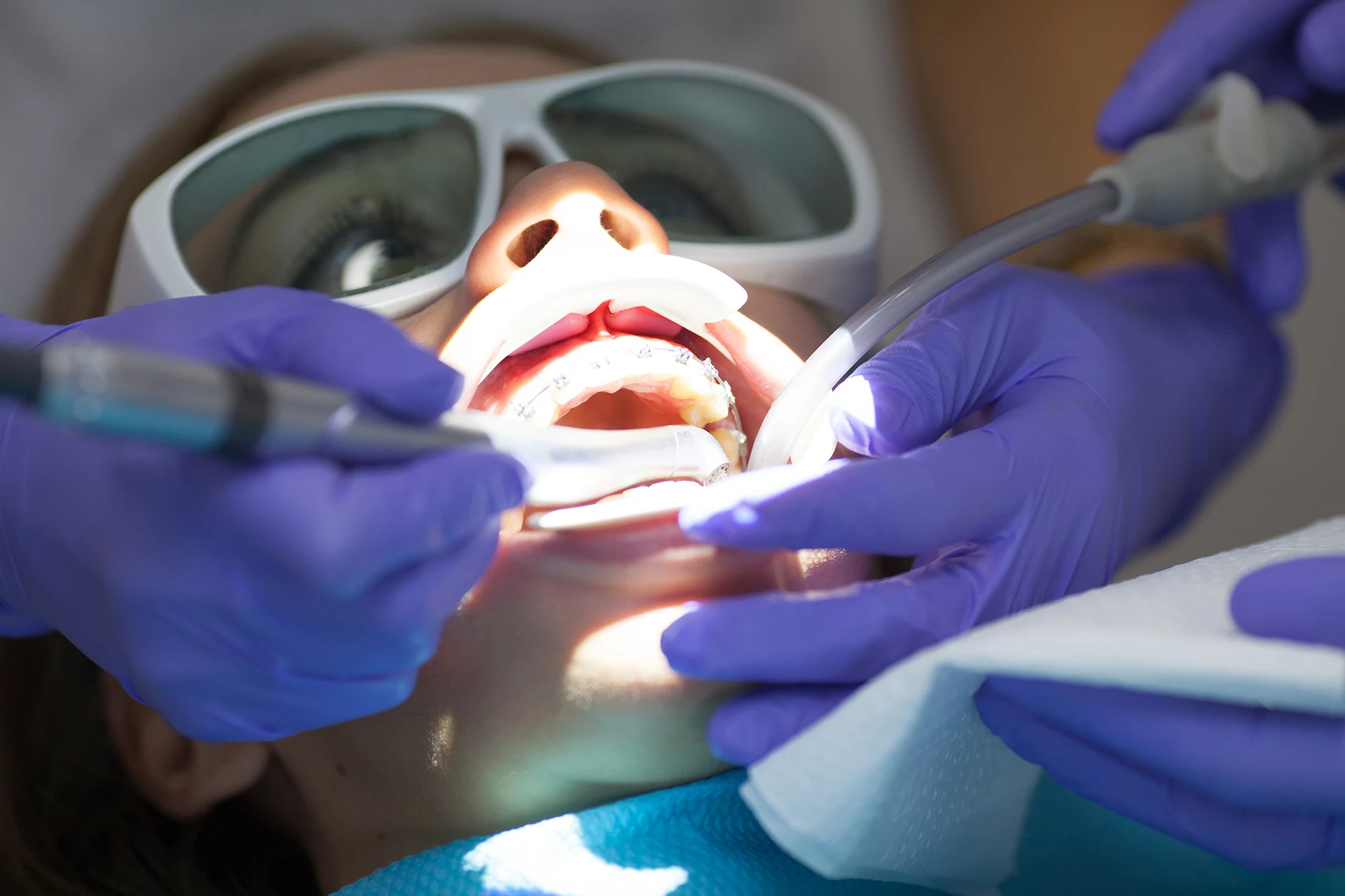 All-Tissue Laser Therapy