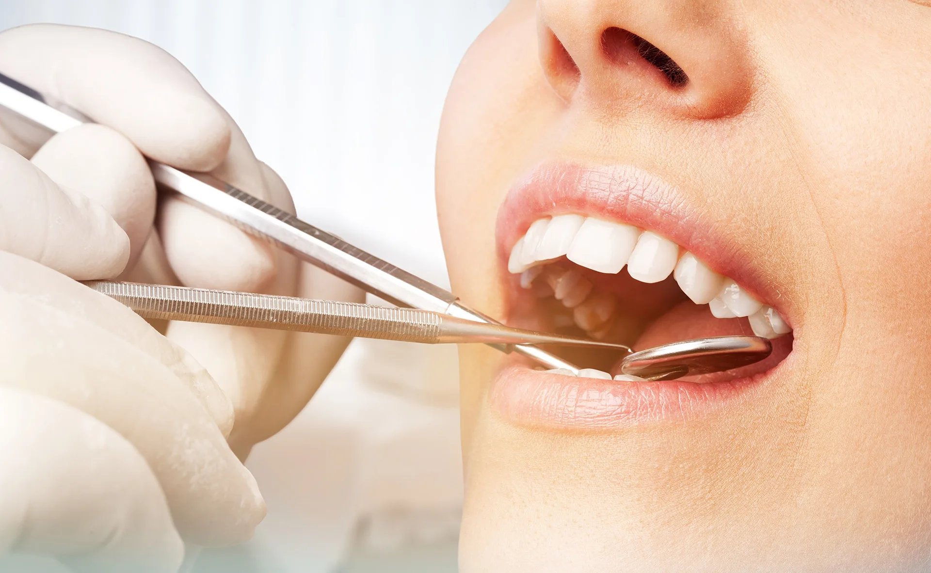 Periodontal Care