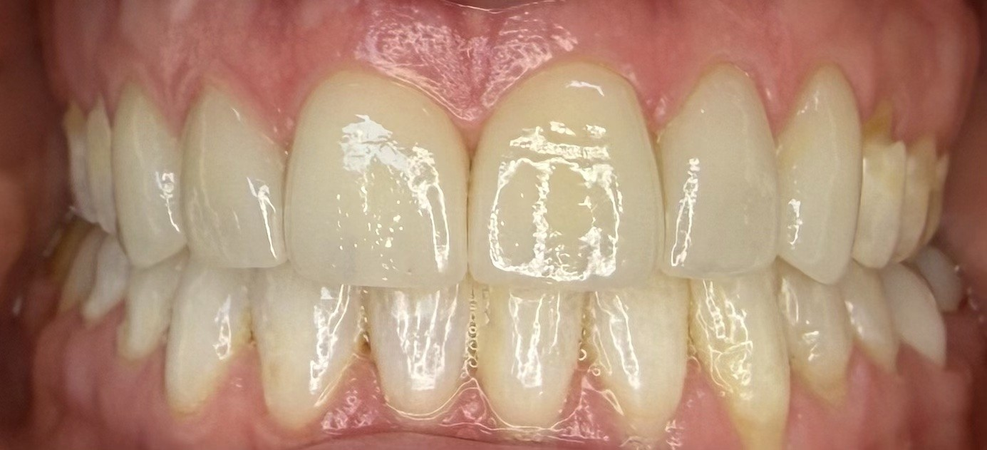 After Image