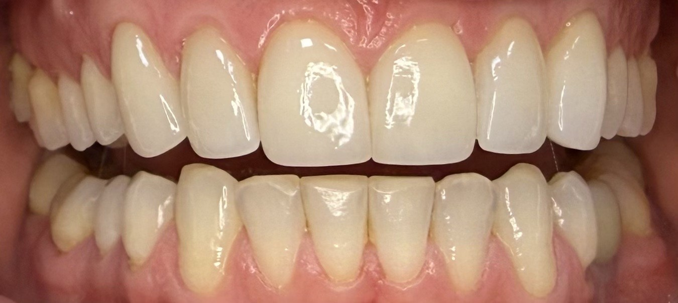 After Image