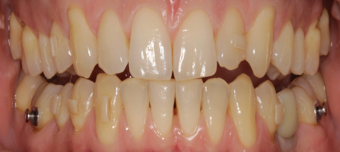 Before Image