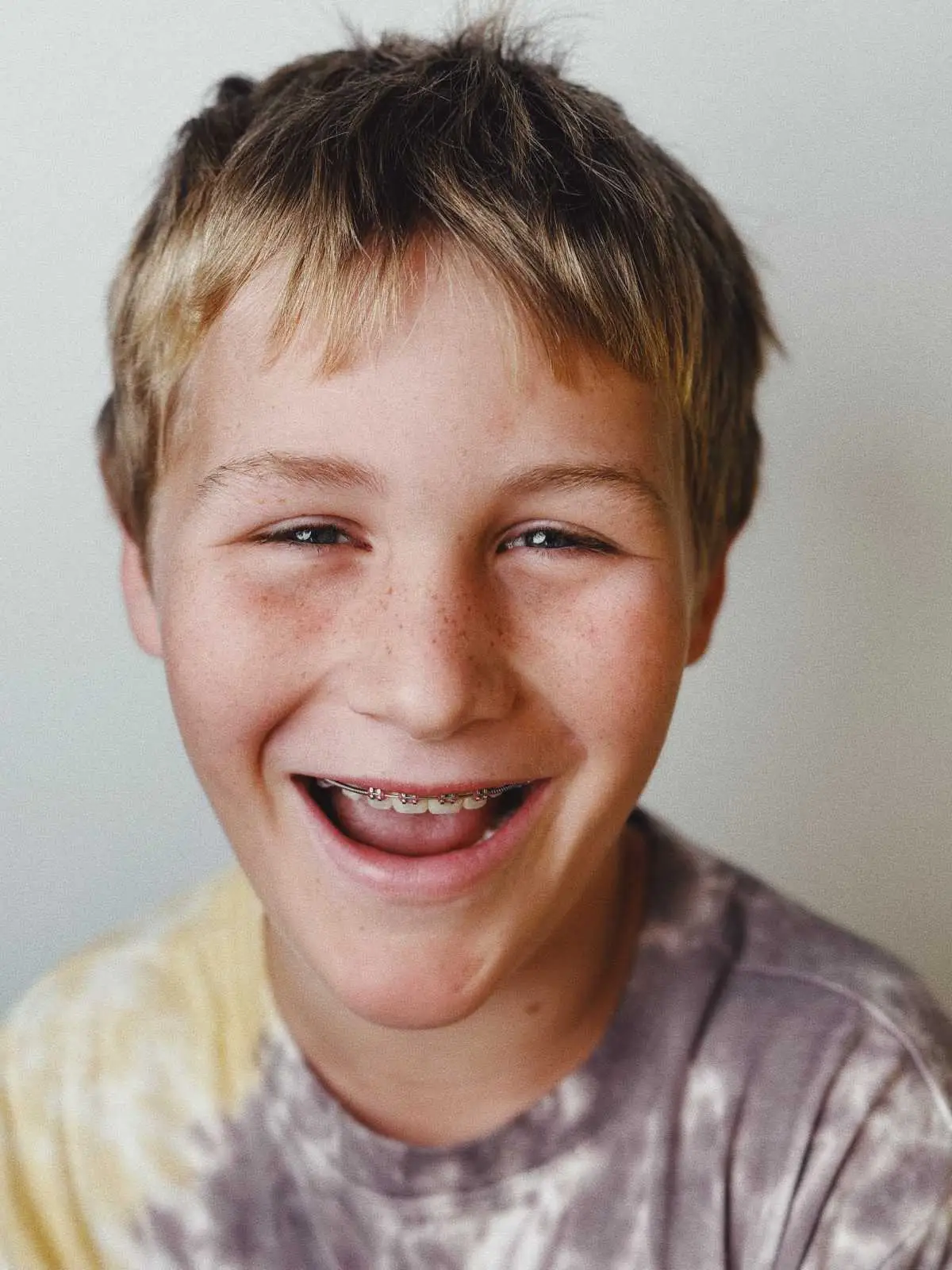 smiling boy with braces and a tye-dye tee shirt