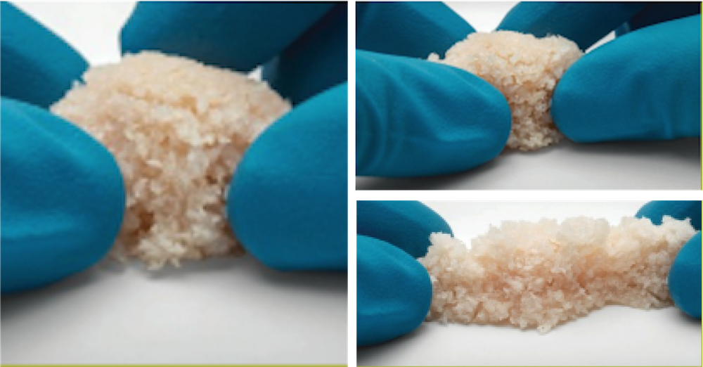 Moelleken M, Jockenhöfer F, Benson S, Dissemond J. Prospective clinical study on the efficacy of bacterial removal with mechanical debridement in and around chronic leg ulcers assessed with fluorescence imaging. Int Wound J. 2020 Aug;17(4):1011-1018.