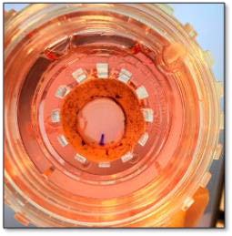   Moelleken M, Jockenhöfer F, Benson S, Dissemond J. Prospective clinical study on the efficacy of bacterial removal with mechanical debridement in and around chronic leg ulcers assessed with fluorescence imaging. Int Wound J. 2020 Aug;17(4):1011-1018.