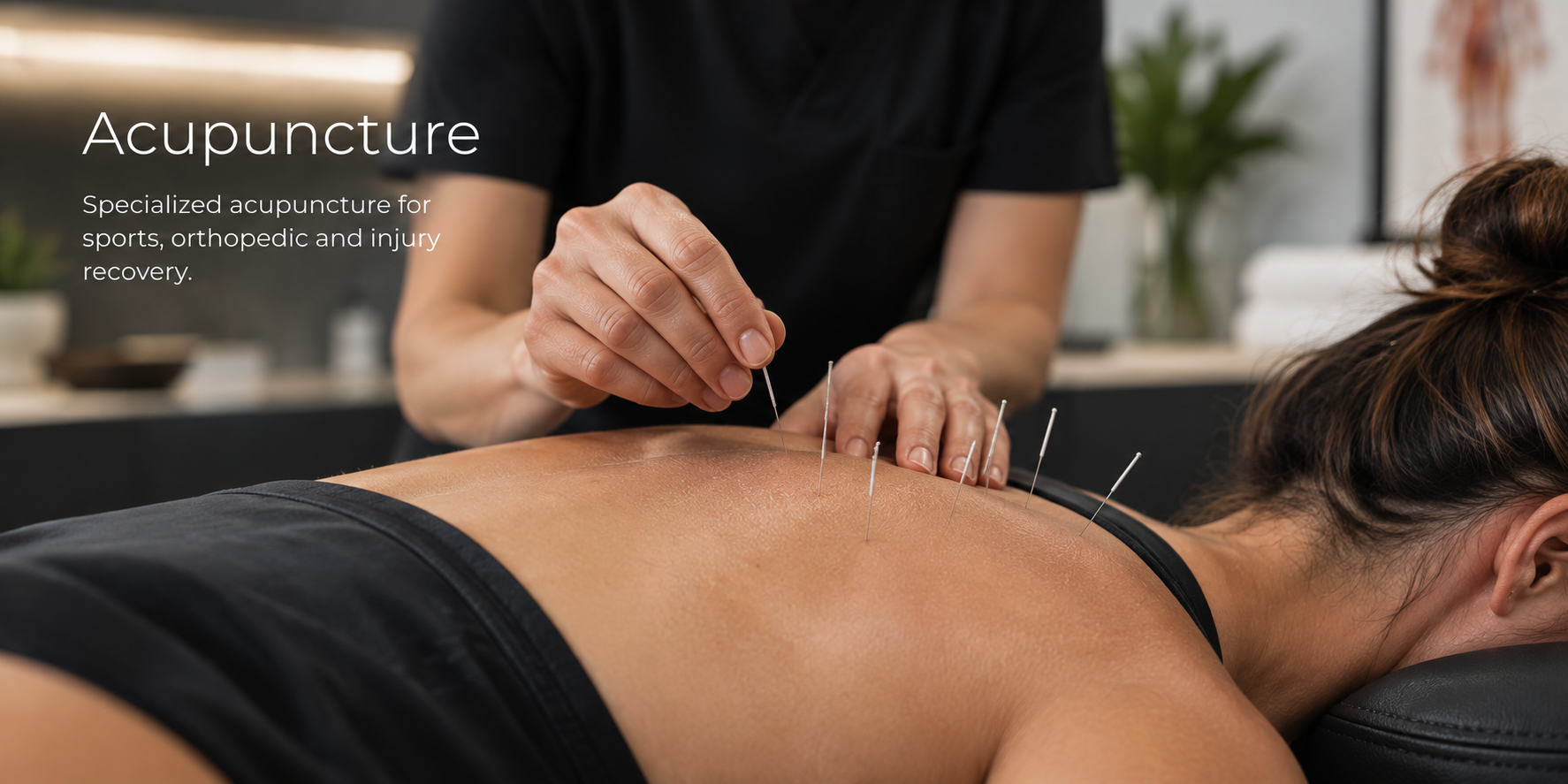 Close-up of acupuncture needles inserted into a patient's skin during treatment at a holistic clinic in Pittsburgh