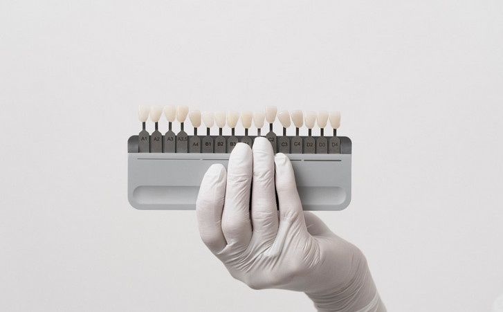 benefits of dental implants