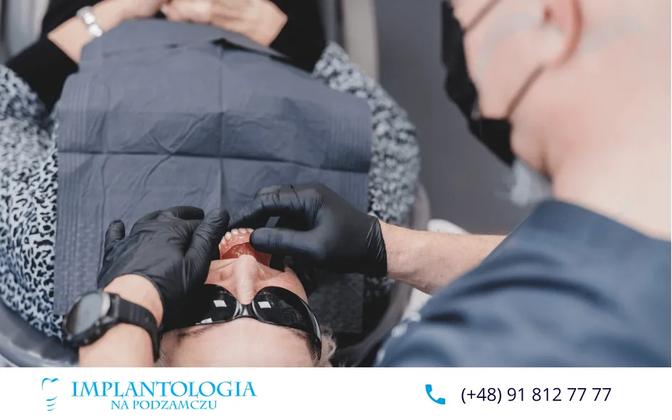 all-on-4-vs-tradycyjne-protezy