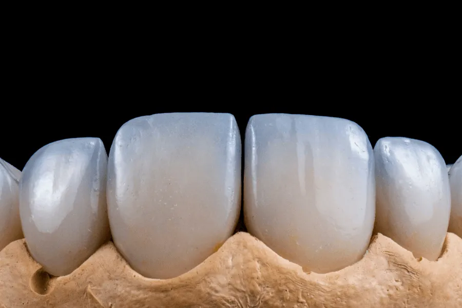 all-on-x-alternatywa-dla-augmentacji-kosci