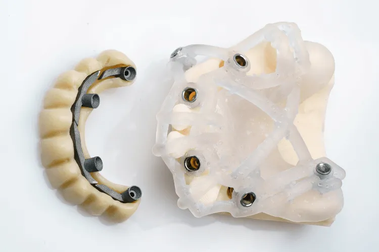 odbudowa-calego-luku-zebowego