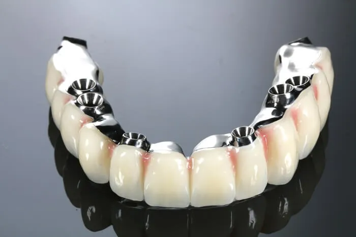 Most hybrydowy stosowany w leczeniu metodą All-on-4 z mocowaniem na implantach