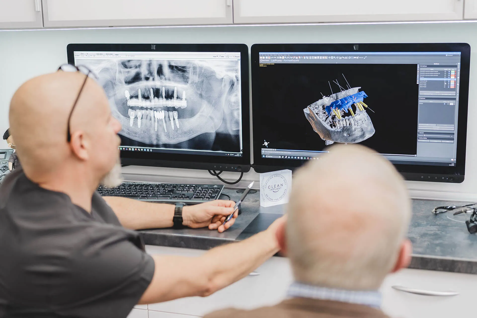 Cyfrowe planowanie leczenia All-on-4 z wykorzystaniem tomografii CBCT i technologii CAD/CAM przed wszczepieniem implantów w Szczecinie