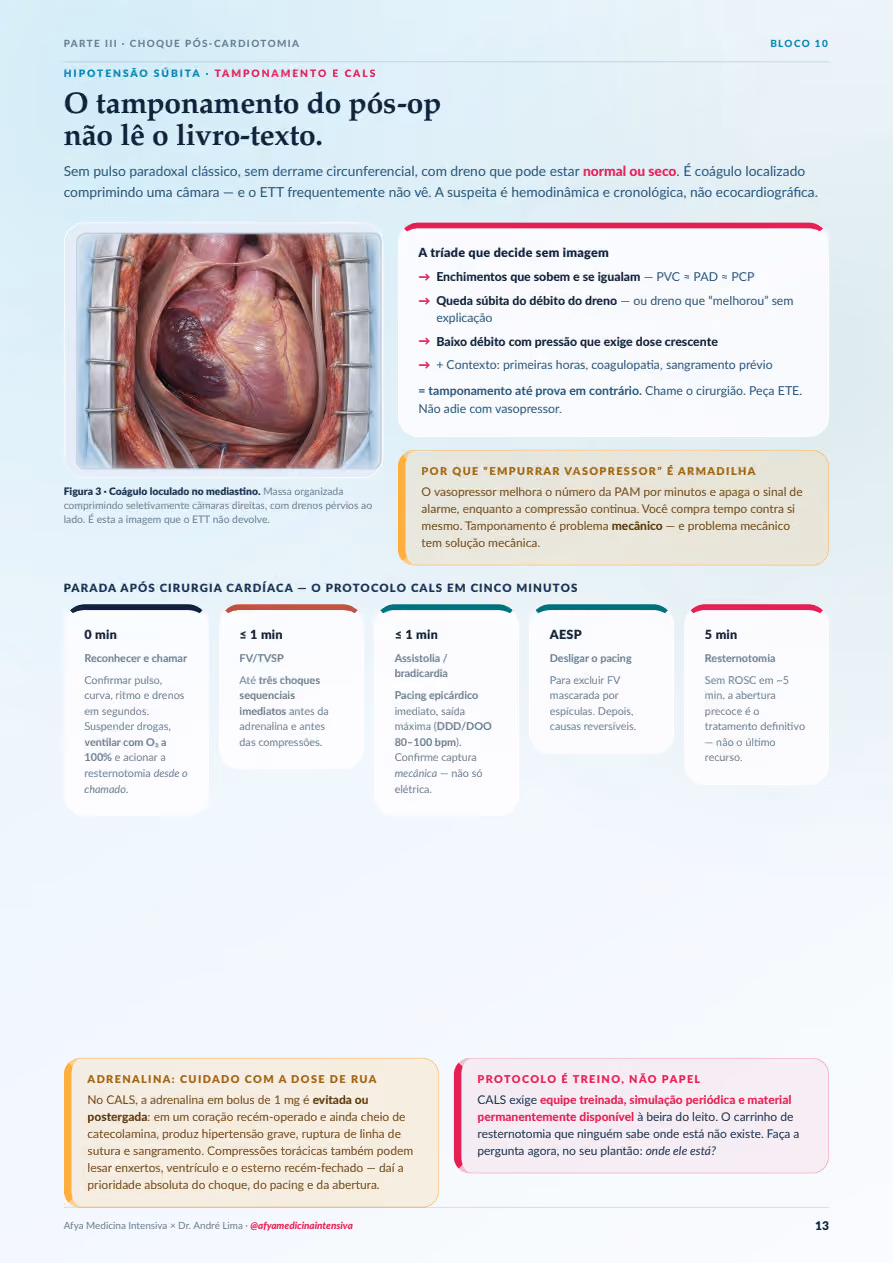 Tamponamento e CALS