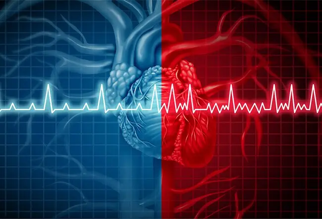 What is Heart Rate Variability?