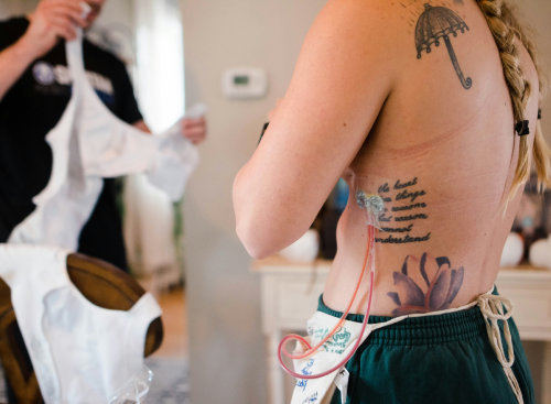 Cancer du sein chez la femme jeune : soins et accompagnement