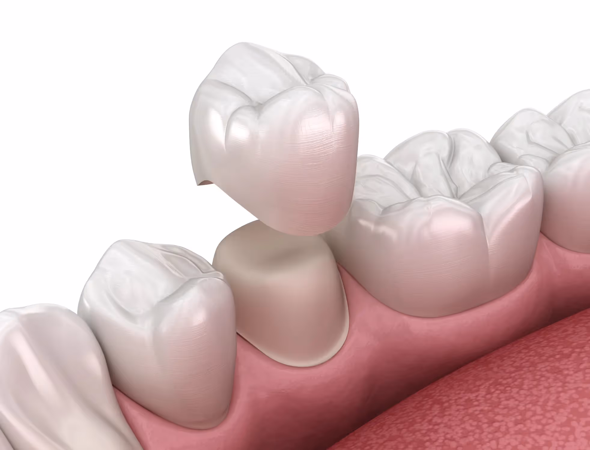 Pediatric Restorative Dentistry in Waldo