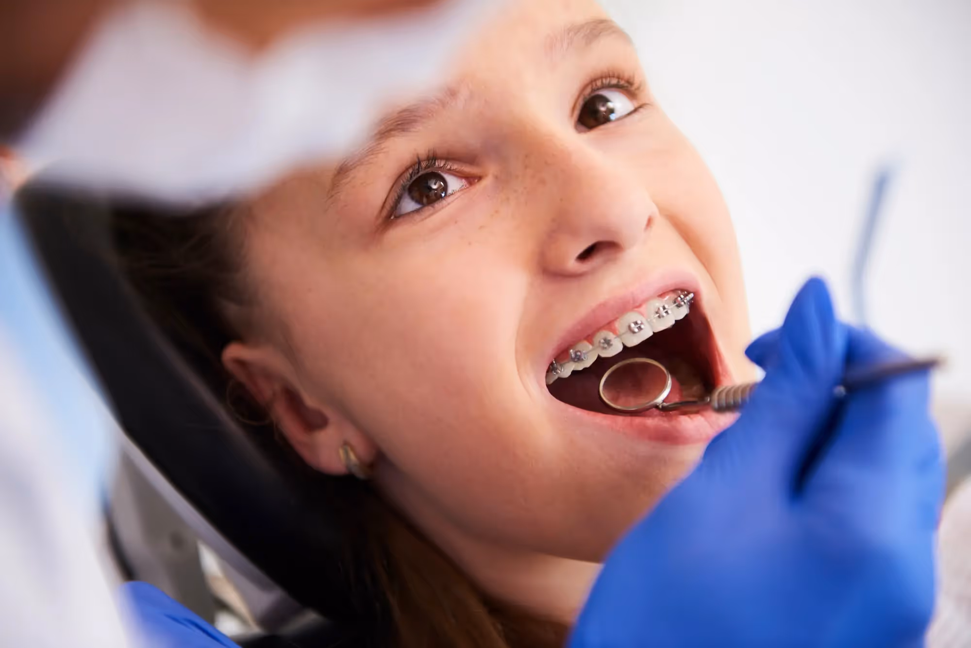 Child Orthodontics in Independence