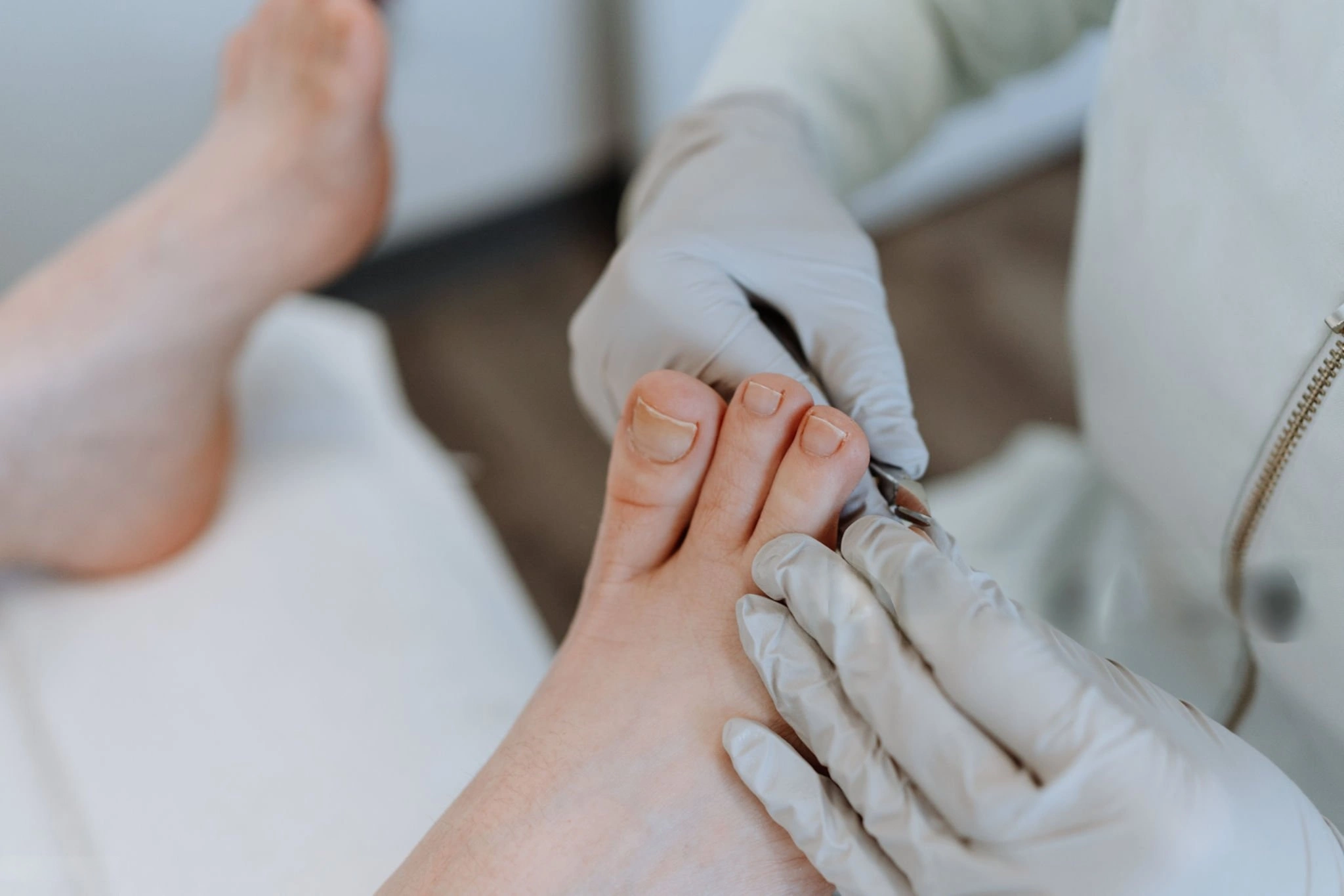 Toenail and fingernail fungus