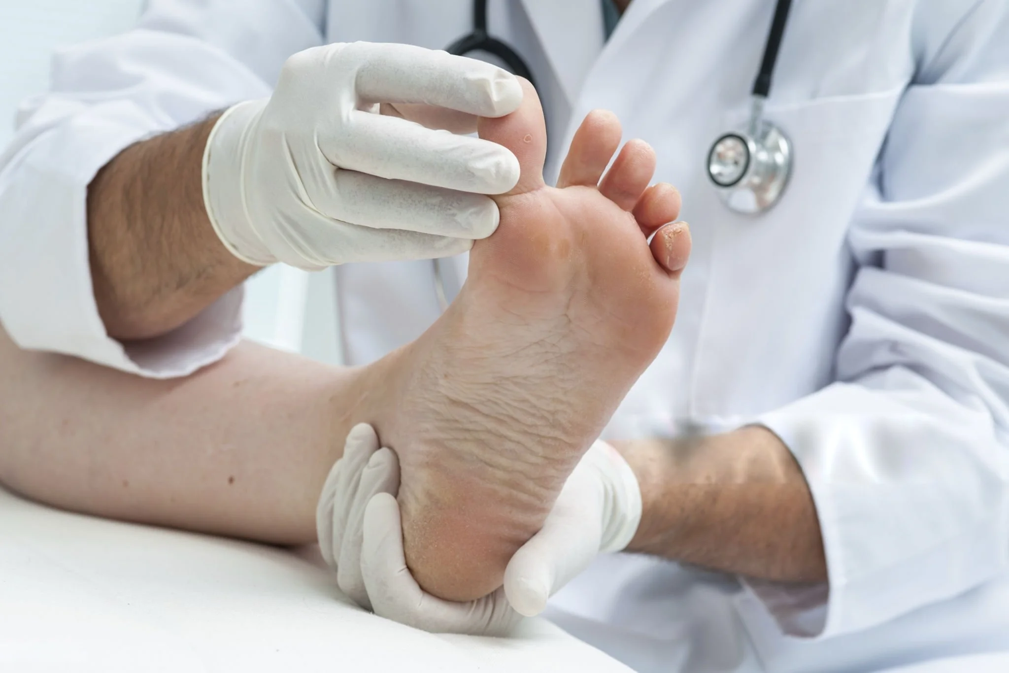 athlete’s foot and toenail fungus