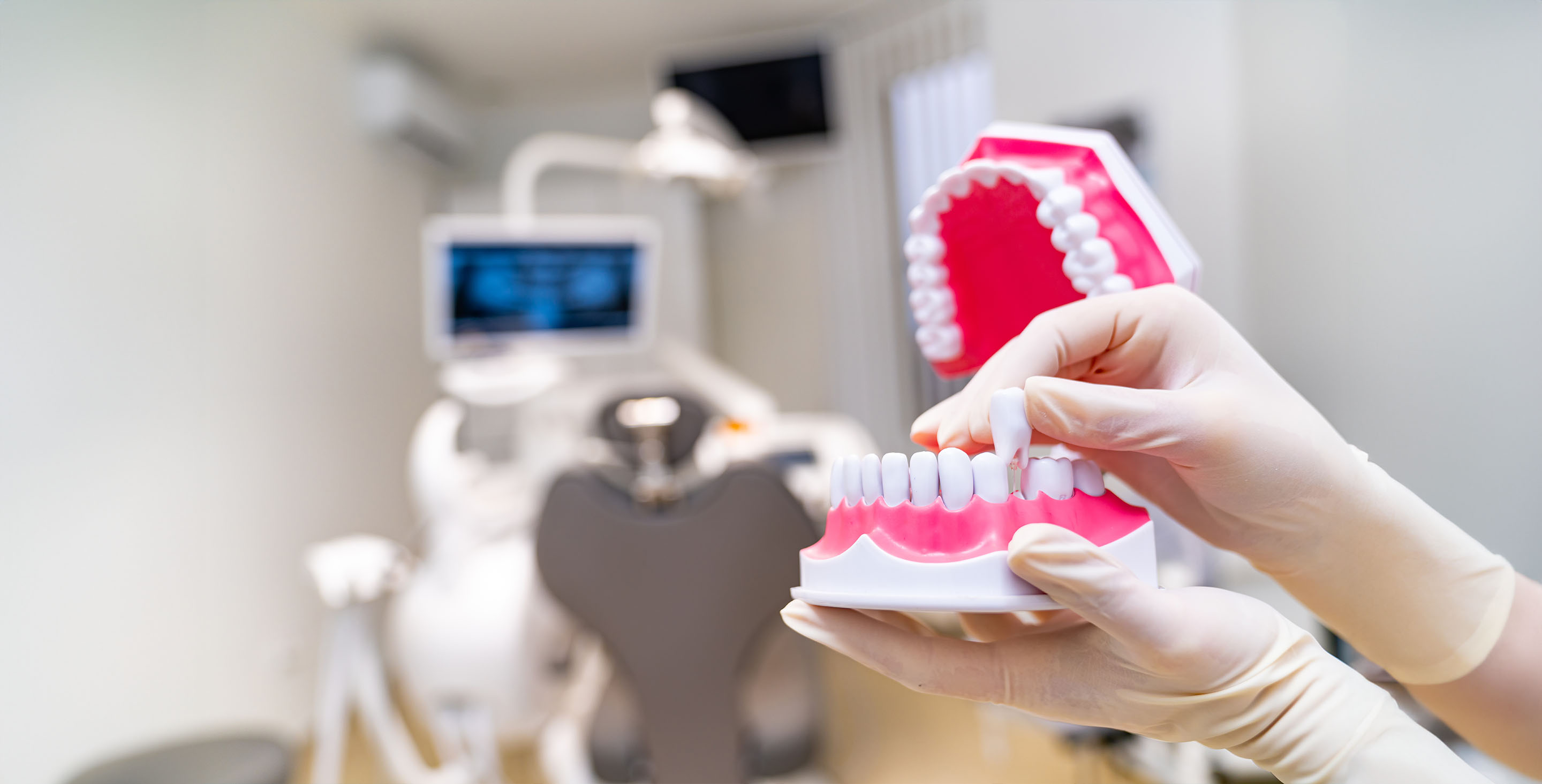 Tooth Extraction Service in Kanata