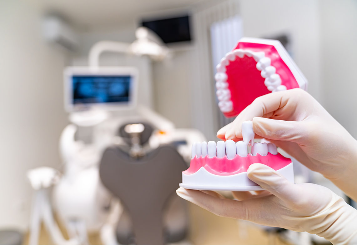 Tooth Extraction Service in Kanata