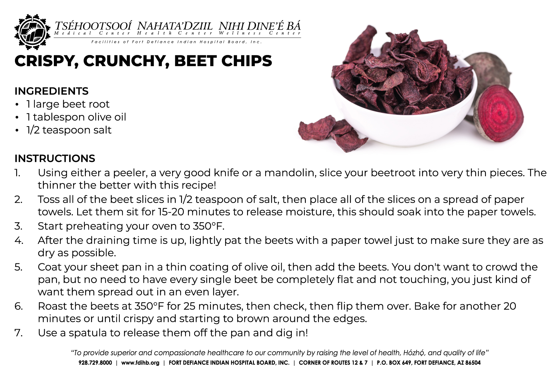 Healthy Lifestyle Habits & Nutrition: Beet Chips