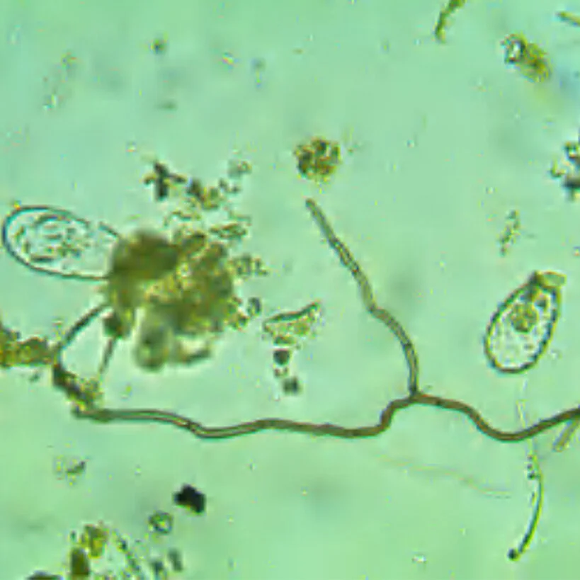 Photo de Hyphes Septa ramifiée et thécamibien.