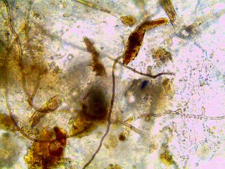 Photo de Longue hyphes basidiomycète