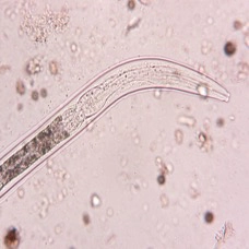 Nématode bactérivore (grossissement 400x)