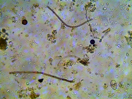 Sol observé au microscope