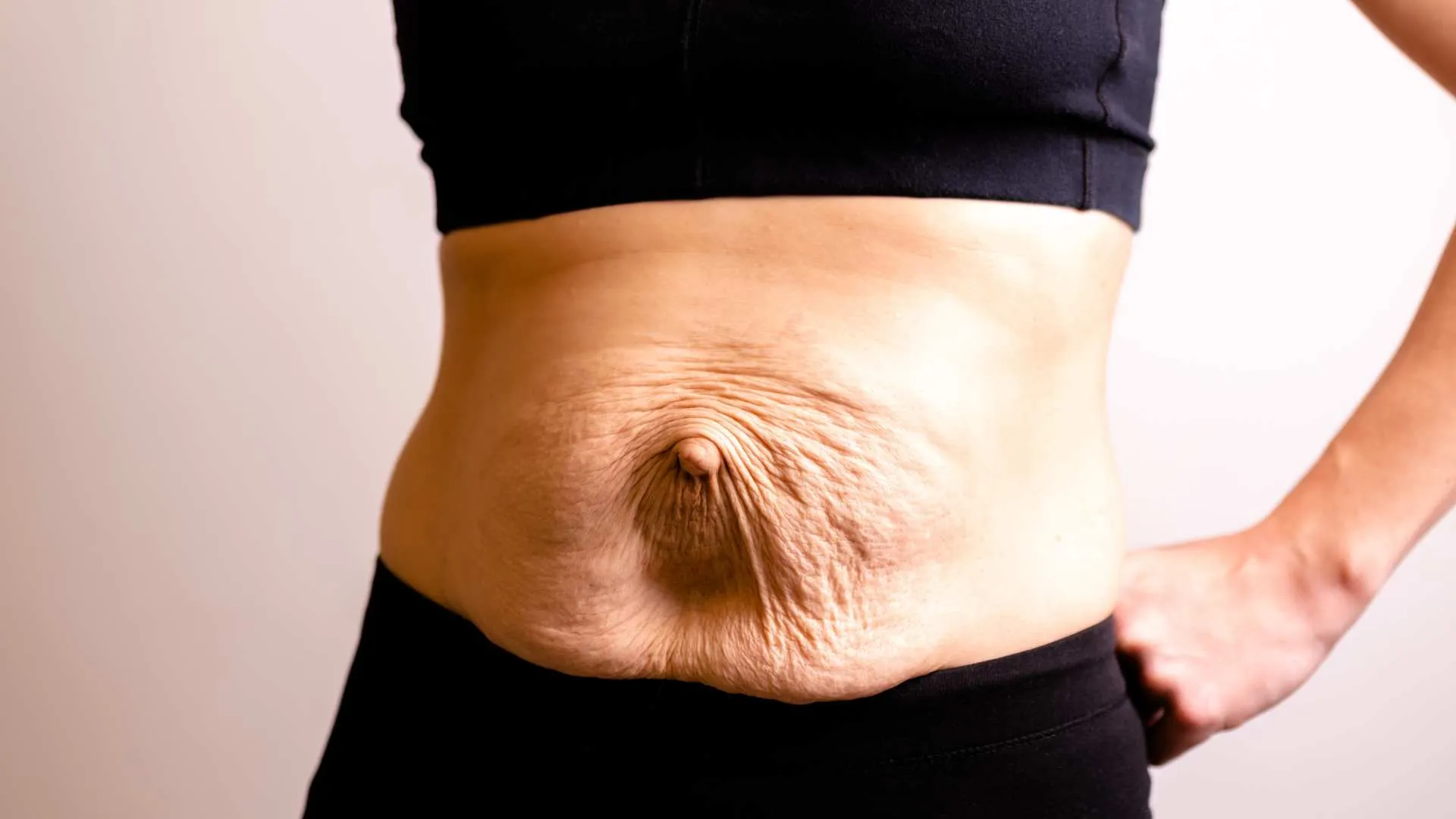 Mommy Makeover: más que una transformación estética, una reconexión contigo misma