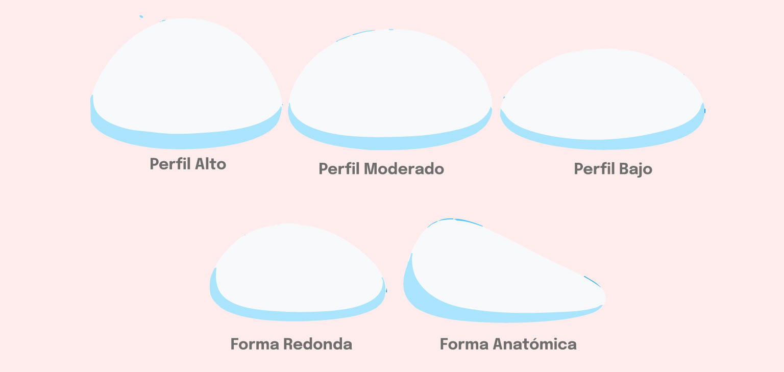 Gráfica de la forma y proyección de los implantes mamarios