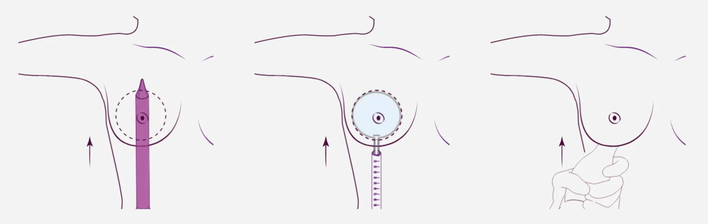 explicacion tecnica motiva