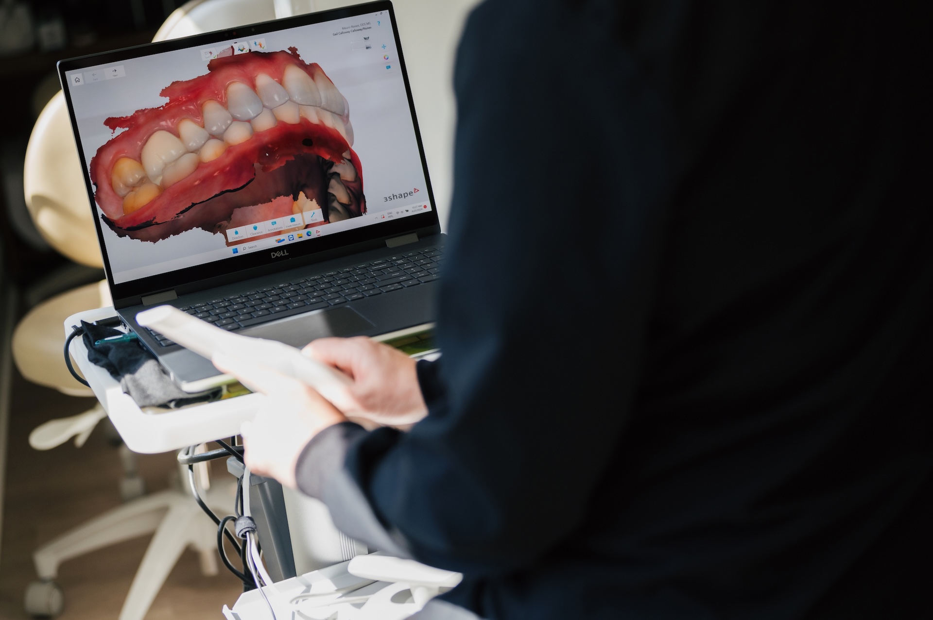 Dentist reviewing a 3D digital scan of teeth on a laptop in a dental office.