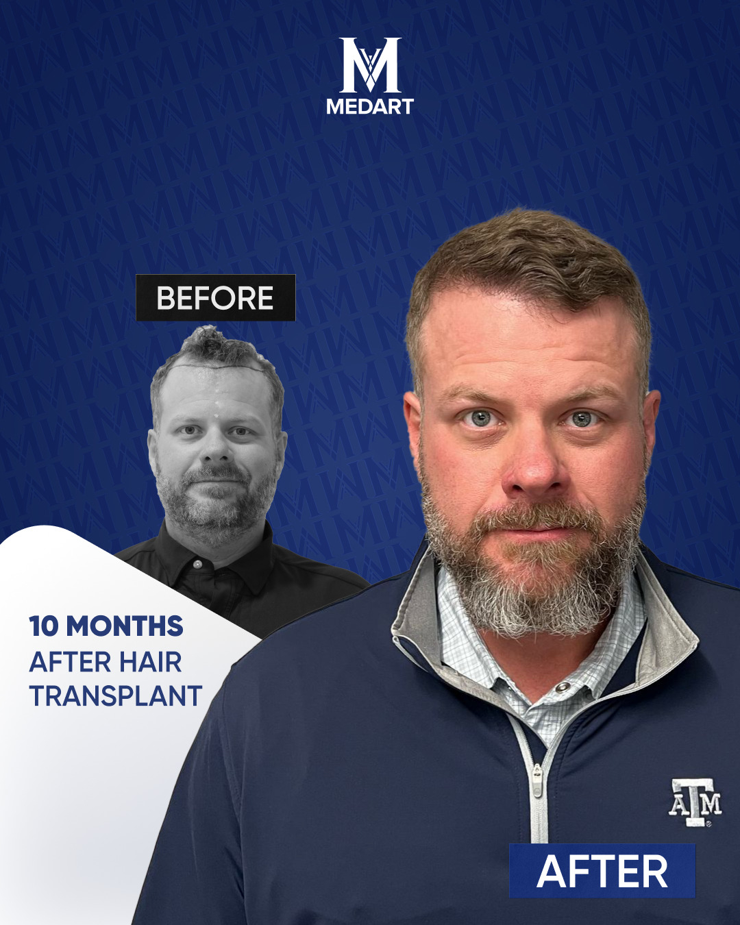 Source:  FL Communications (EZ Newswire)