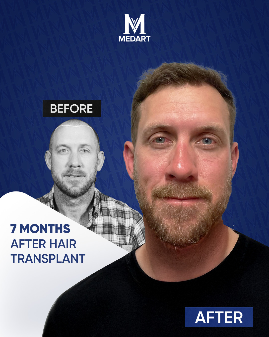 Source:  FL Communications (EZ Newswire)